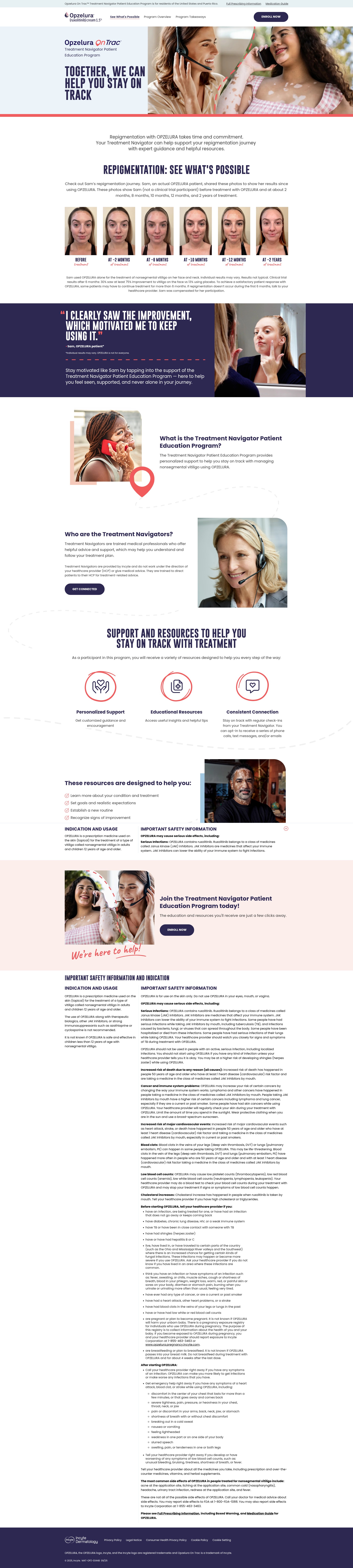 Screenshot of www.opztreatmentnav.com